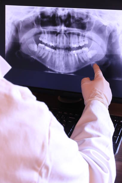 Best Emergency Root Canal Treatment in Romney, WV