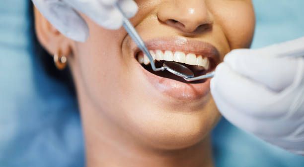 Best Emergency Broken Tooth Repair in Romney, WV